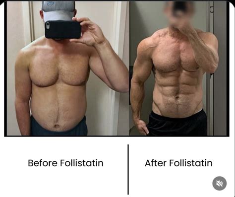 25 000 Follistatin Gene Therapy Before After Results Analysis With Peter Attia More Plates More Dates Podcast On Spotify 25 000 Follistatin Gene Therapy Before After Results Analysis With Peter Attia More Plates More Dates Podcast On Spotify