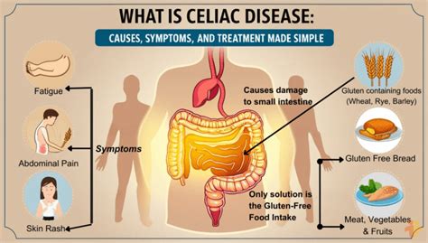 Celiac Disease Causes Symptoms And Treatment Options Celiac Disease Causes Symptoms And Treatment Options
