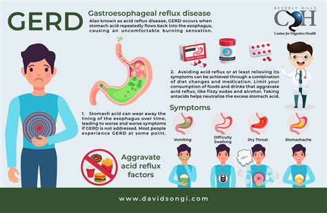 Gerd Symptoms And Causes Gastroenterologist Los Angeles Gerd Symptoms And Causes Gastroenterologist Los Angeles
