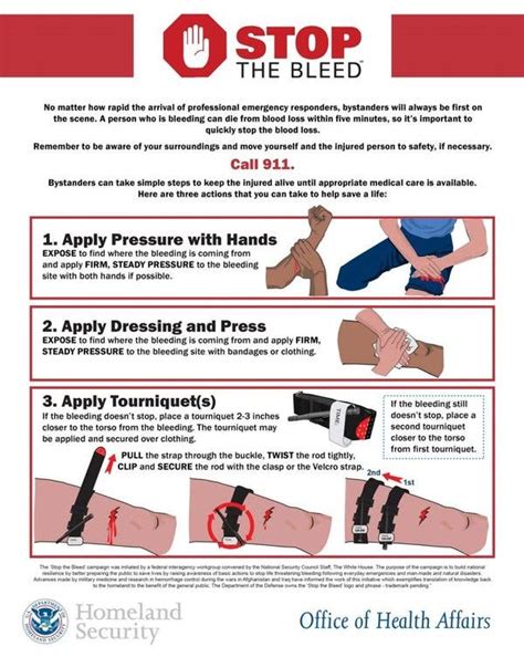 How To Stop Bleeding And Save A Life The New York Times How To Stop Bleeding And Save A Life The New York Times