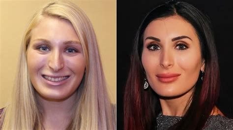 Laura Loomer Looked So Different Before All The Plastic Surgery