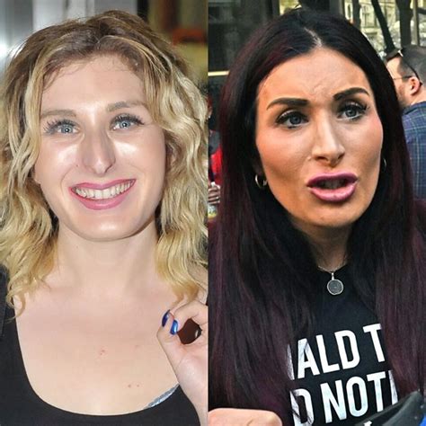 Laura Loomer Plastic Surgery Face Before And After Photos