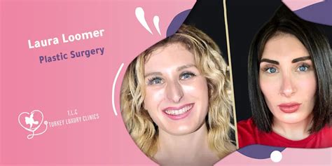 The Truth Behind Laura Loomer Plastic Surgery