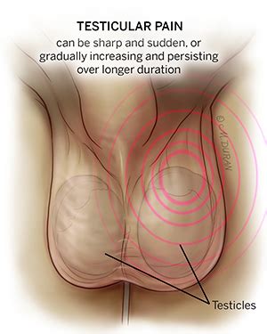Ut Health Austin Testicular Pain